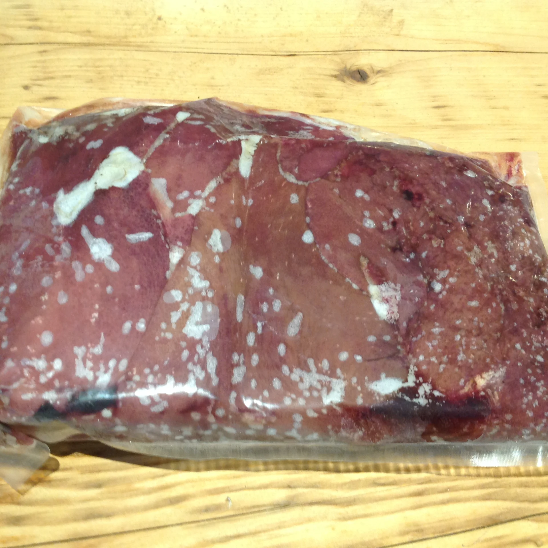 Liver