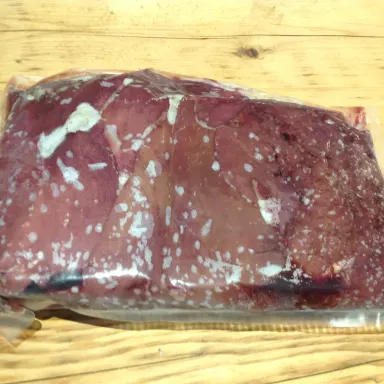 Liver